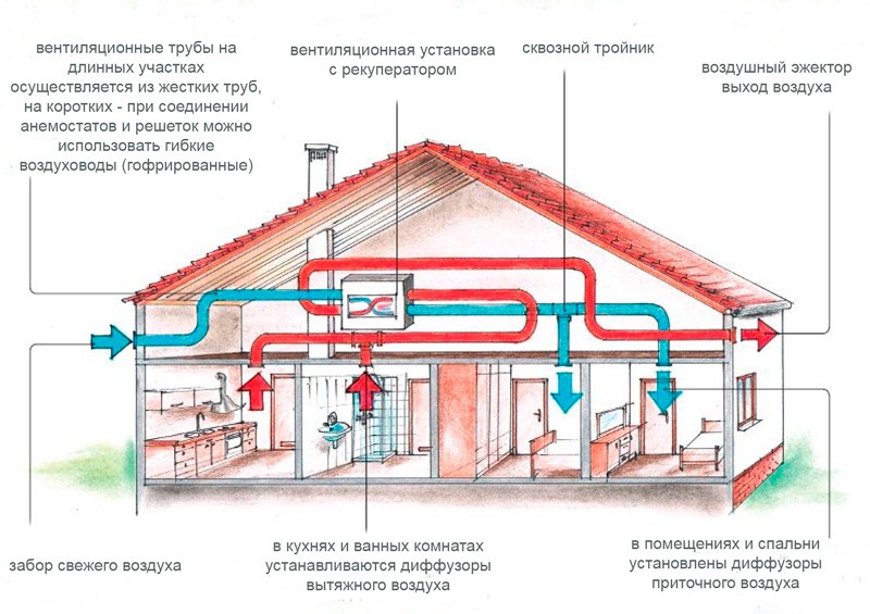 Механическая вентиляция